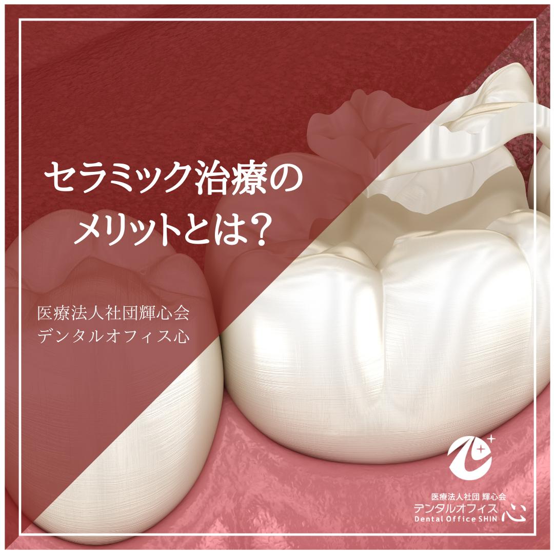 セラミック治療のメリットとは？
