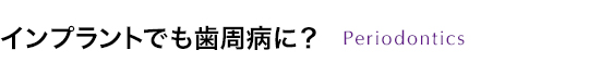 インプラントでも歯周病に？