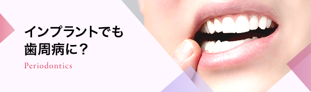 インプラント周囲のティッシュ・マネージメント 健康/医学 ワンピなど 